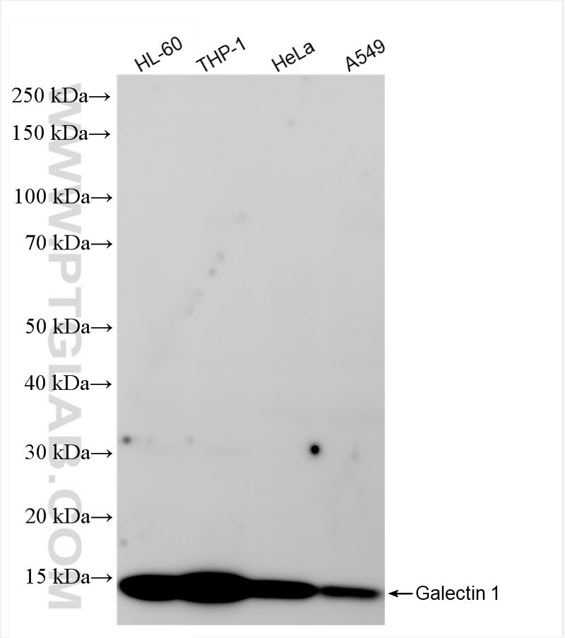 Western Blot (WB) analysis of various lysates using Galectin-1 Recombinant antibody (85091-1-RR)