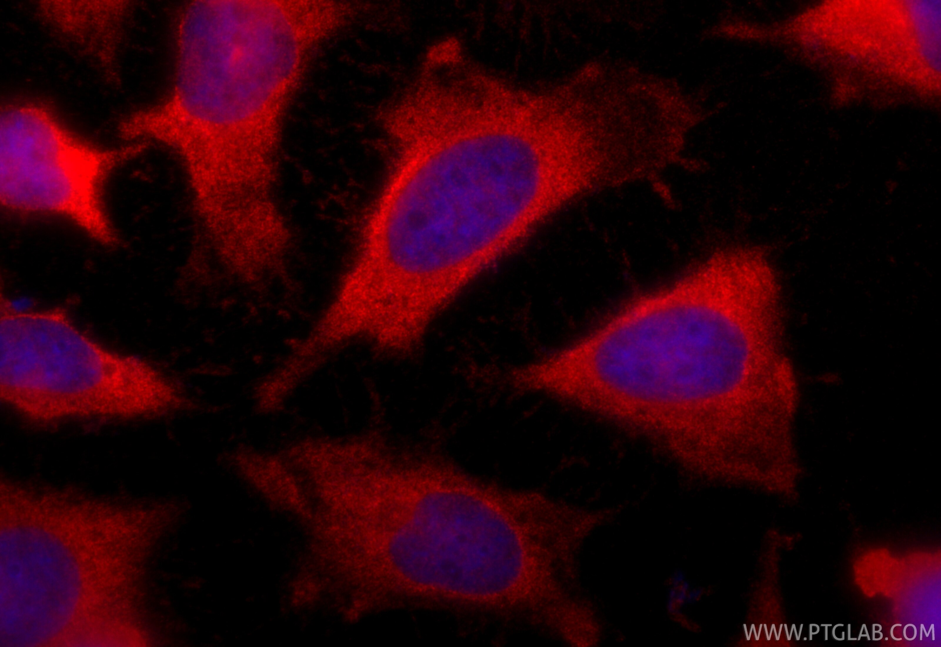 Immunofluorescence (IF) / fluorescent staining of HeLa cells using CoraLite®594-conjugated Galectin-1 Polyclonal anti (CL594-11858)