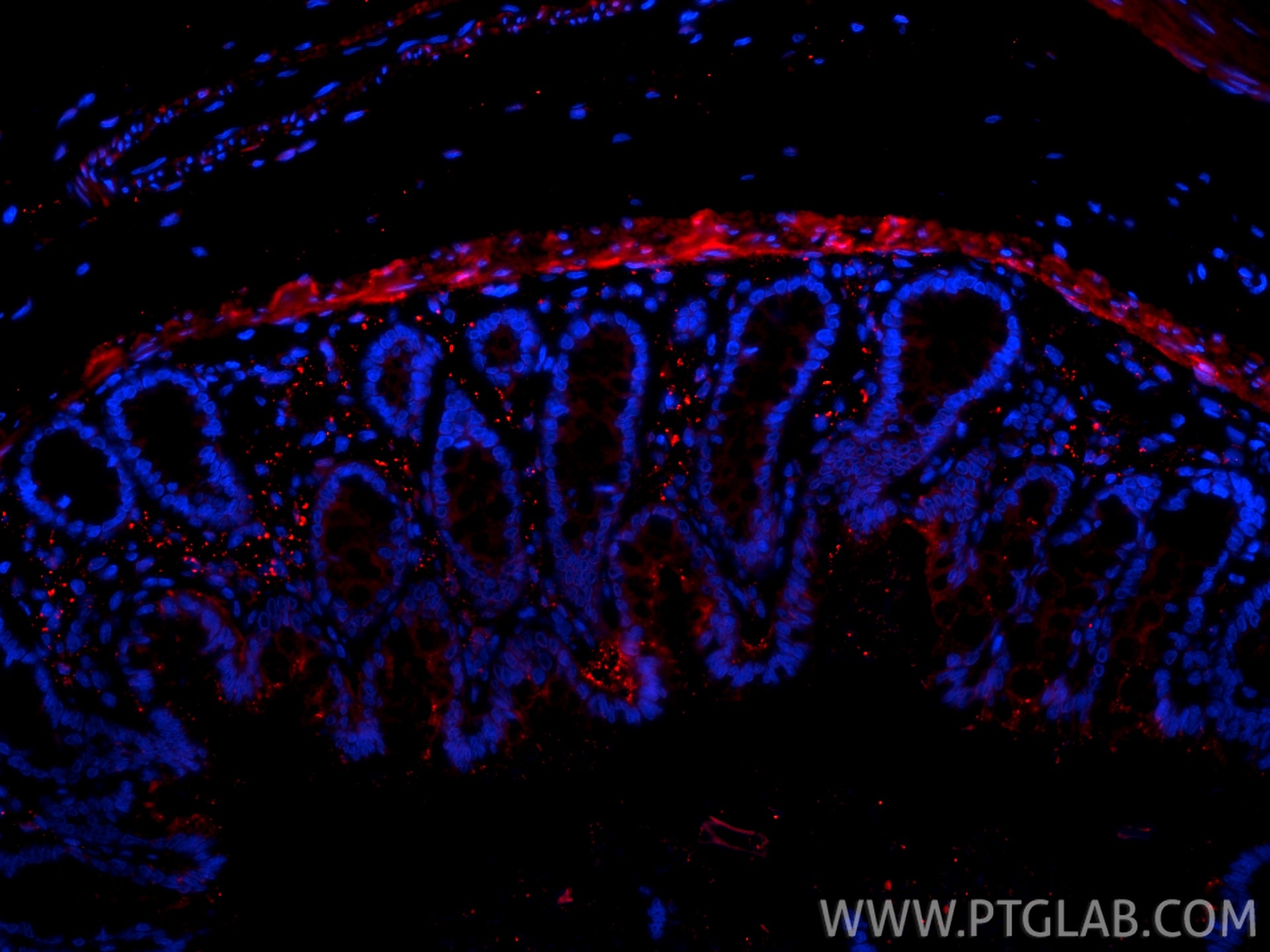 Immunofluorescence (IF) / fluorescent staining of rat colon tissue using CoraLite®594-conjugated Galectin-1 Polyclonal anti (CL594-11858)