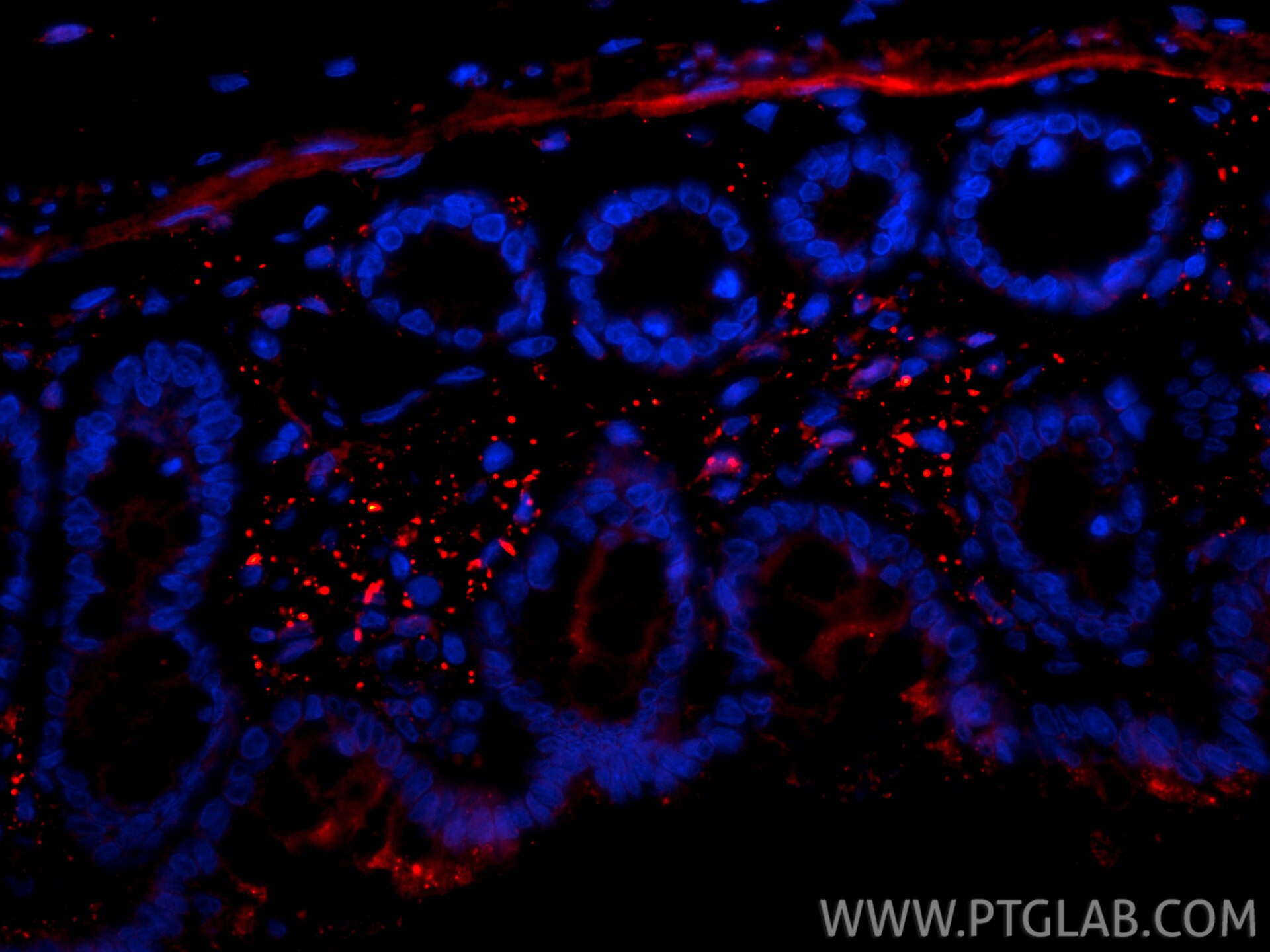 Immunofluorescence (IF) / fluorescent staining of rat colon tissue using CoraLite®594-conjugated Galectin-1 Polyclonal anti (CL594-11858)
