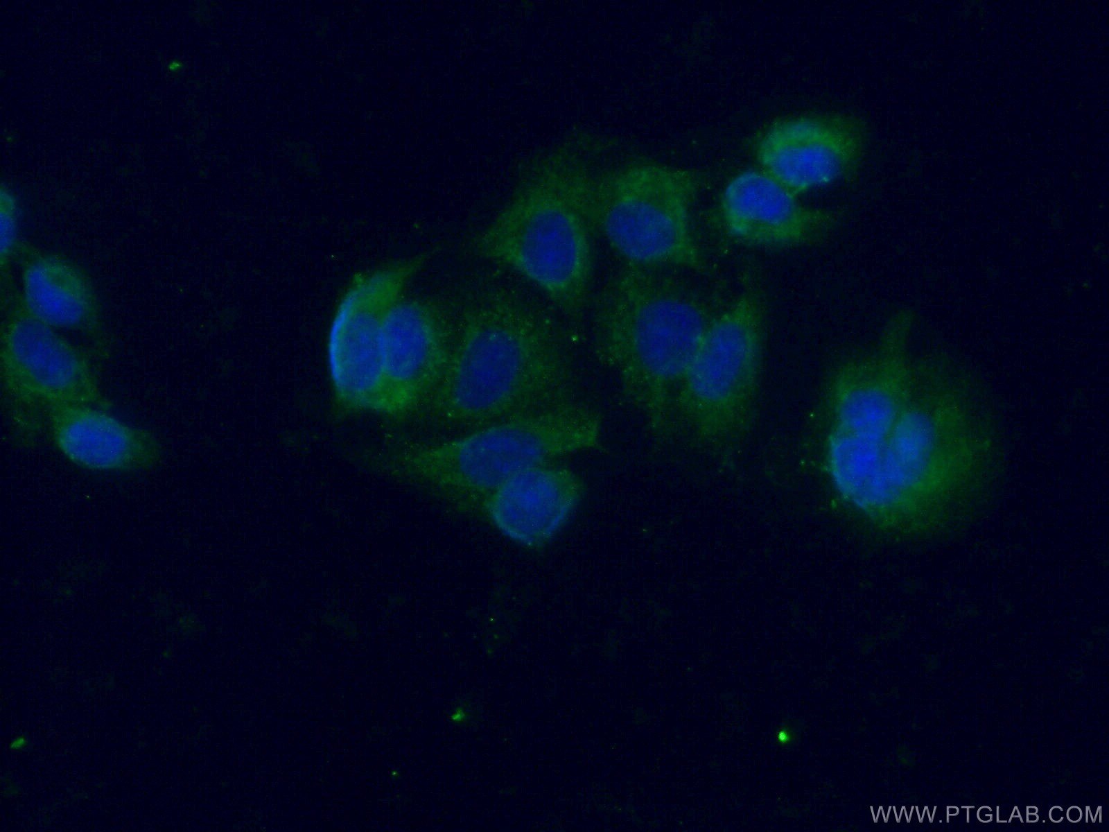 Galectin 10