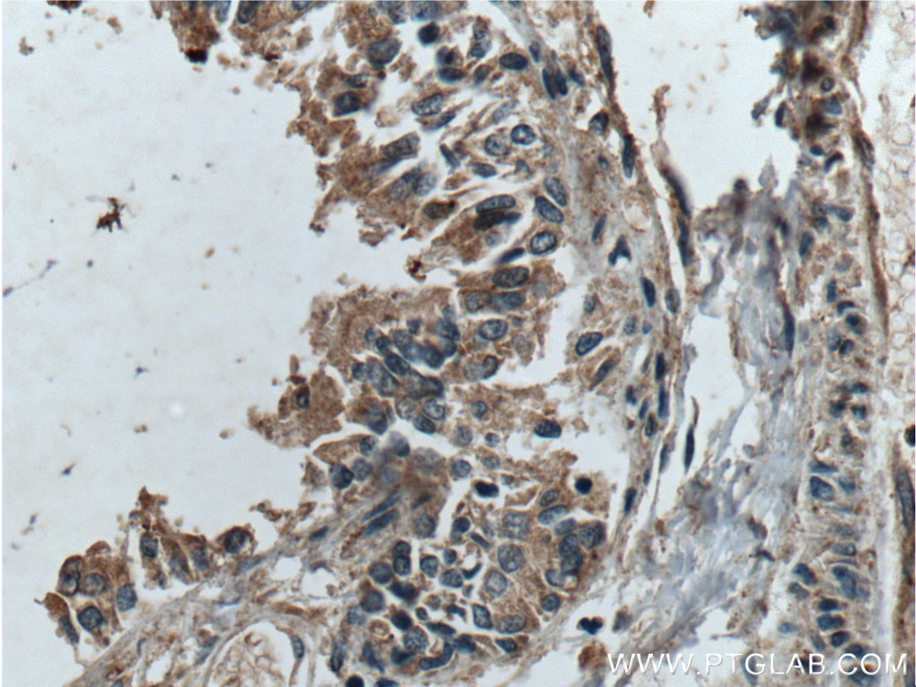 IHC staining of human lung using 25225-1-AP