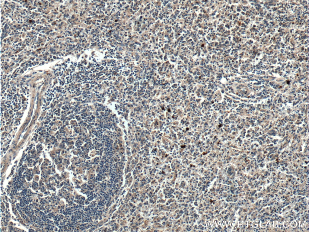 Immunohistochemistry (IHC) staining of human spleen tissue using Galectin 10 Polyclonal antibody (25225-1-AP)