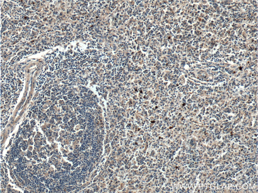 IHC staining of human spleen using 25225-1-AP