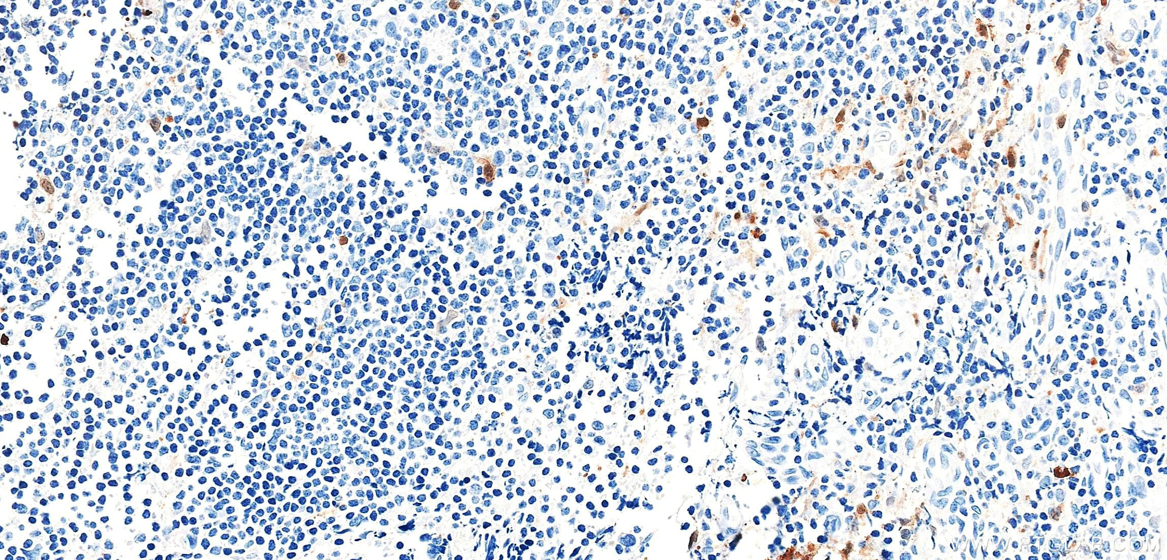 Immunohistochemistry (IHC) staining of human tonsil tissue using Galectin 2 Recombinant monoclonal antibody (87897-1-RR)