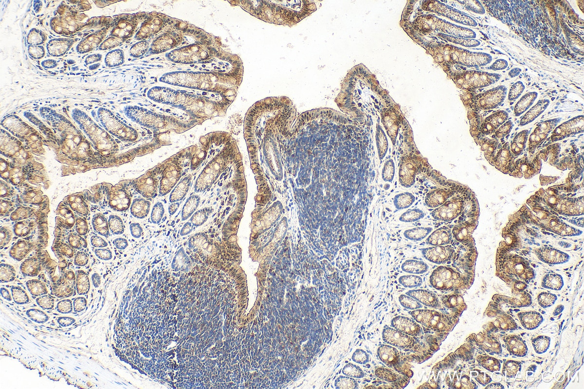 Immunohistochemistry (IHC) staining of mouse colon tissue using Galectin 3 Polyclonal antibody (30450-1-AP)
