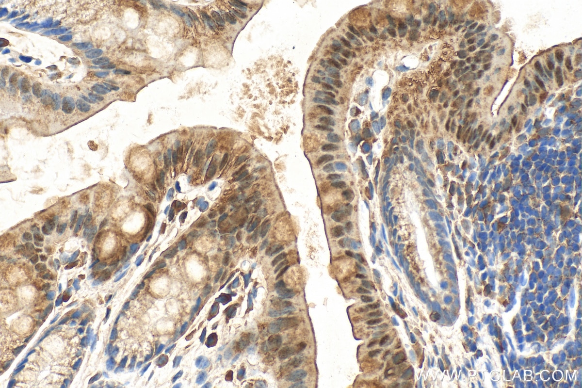 Immunohistochemistry (IHC) staining of mouse colon tissue using Galectin 3 Polyclonal antibody (30450-1-AP)