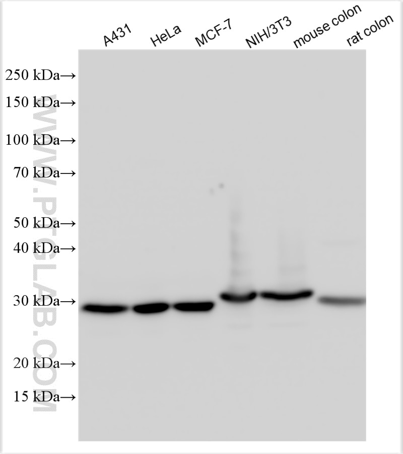 Western Blot (WB) analysis of various lysates using Galectin 3 Polyclonal antibody (30450-1-AP)