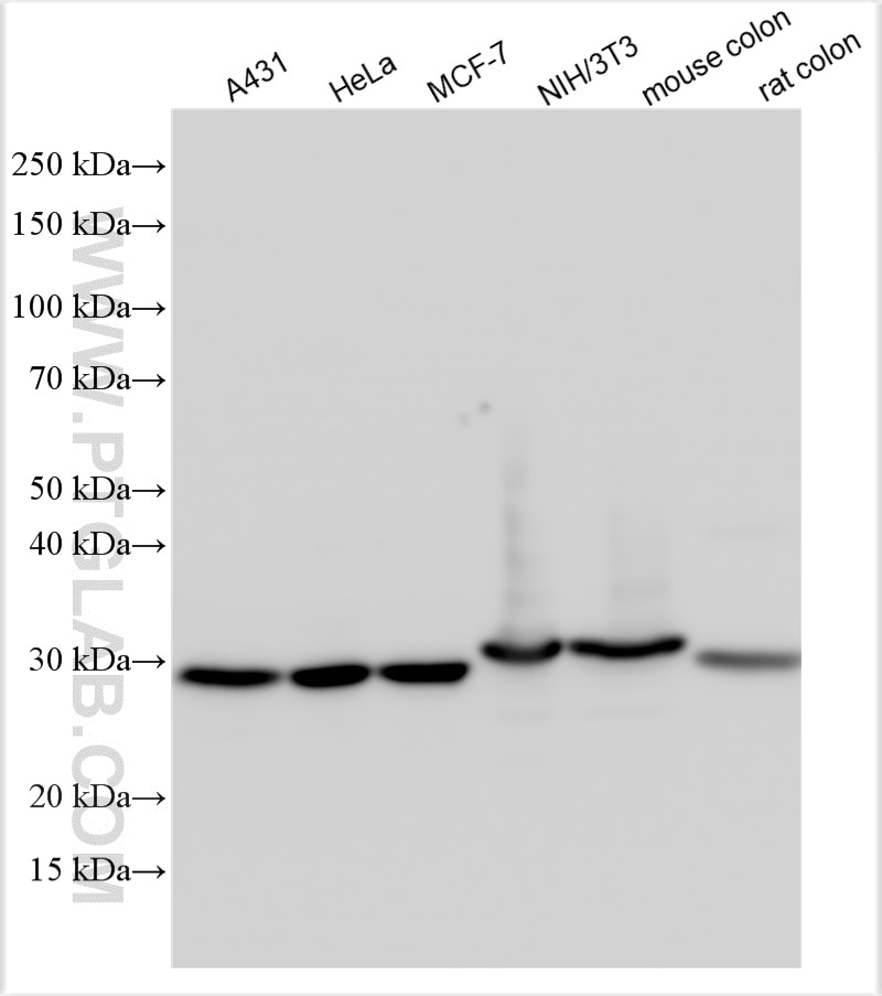 WB analysis using 30450-1-AP