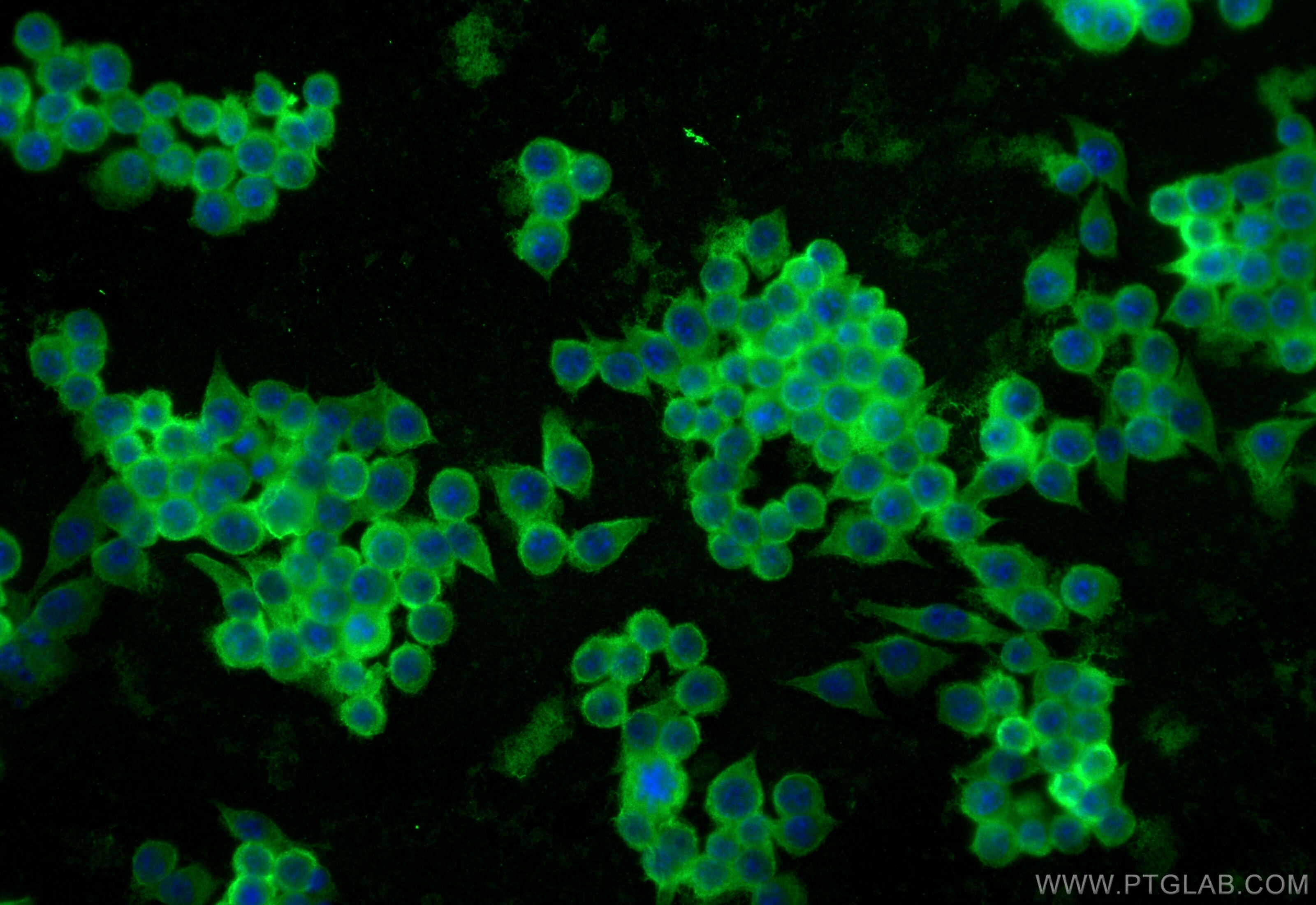 Immunofluorescence (IF) / fluorescent staining of RAW 264.7 cells using Galectin-3 Polyclonal antibody (32664-1-AP)