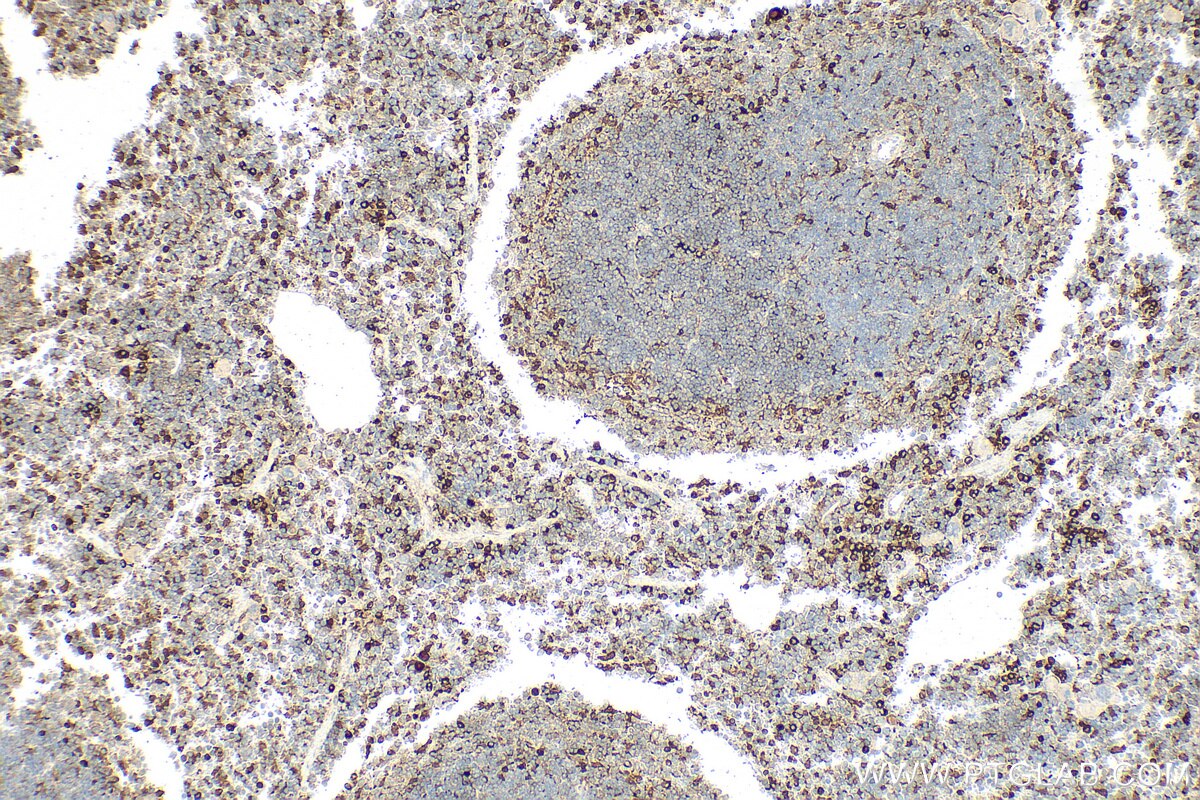 Immunohistochemistry (IHC) staining of mouse spleen tissue using Galectin-3 Polyclonal antibody (32664-1-AP)