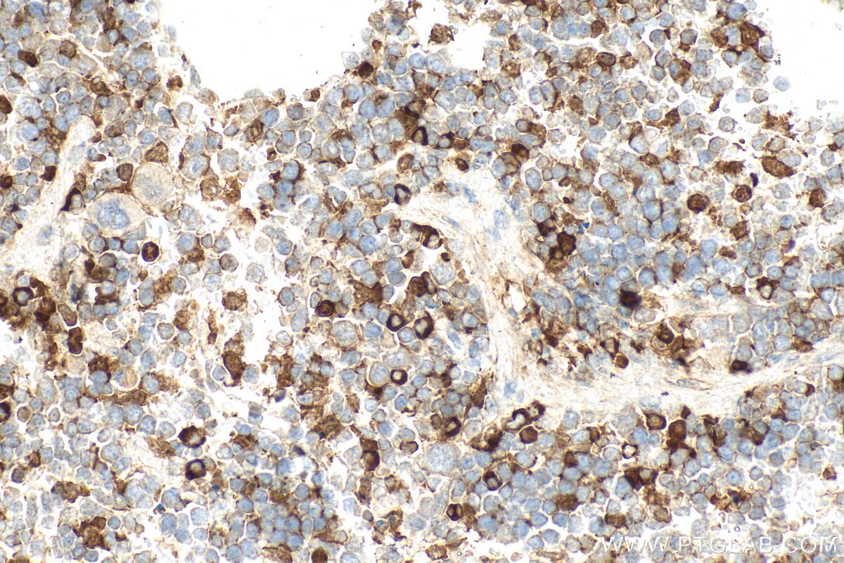 Immunohistochemistry (IHC) staining of mouse spleen tissue using Galectin-3 Polyclonal antibody (32664-1-AP)