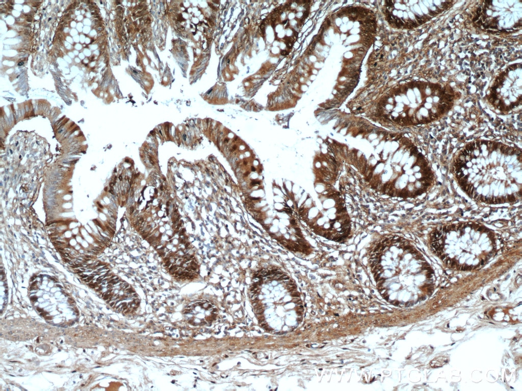 Immunohistochemistry (IHC) staining of human colon tissue using Galectin-3 Monoclonal antibody (60207-2-Ig)