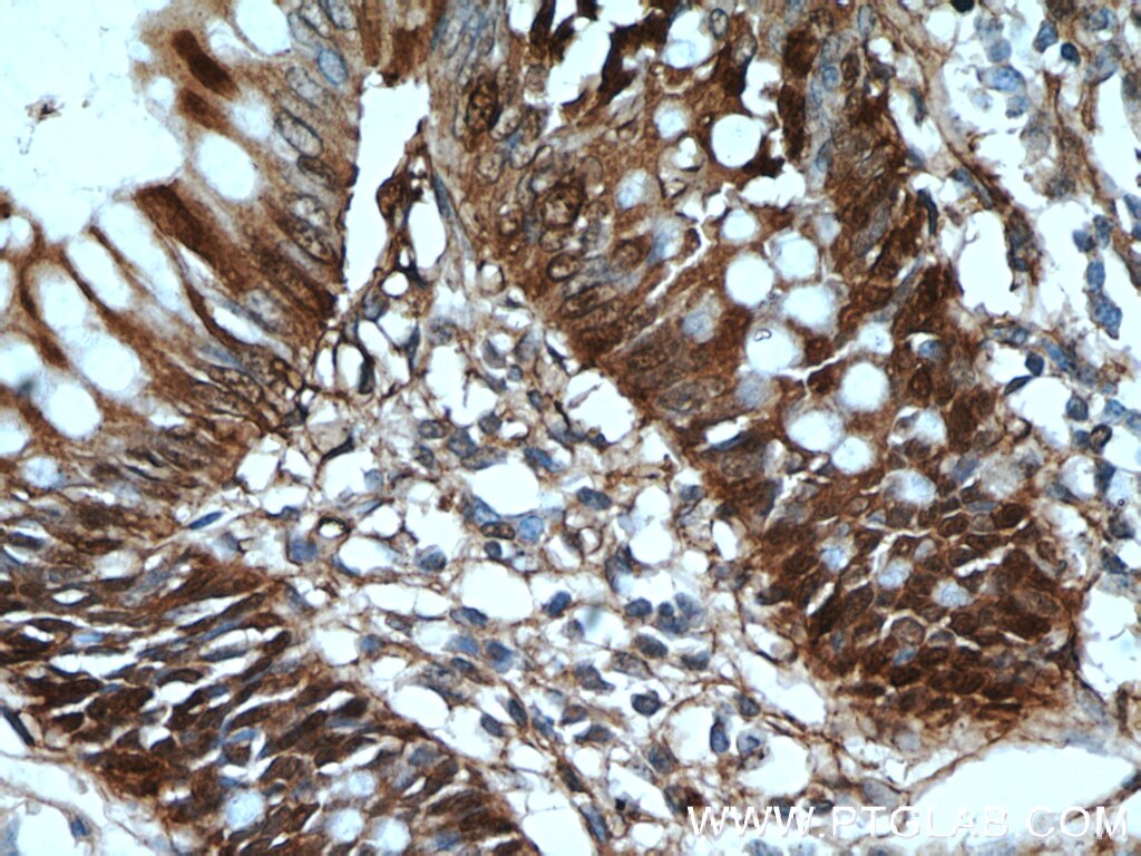 Immunohistochemistry (IHC) staining of human colon tissue using Galectin-3 Monoclonal antibody (60207-2-Ig)