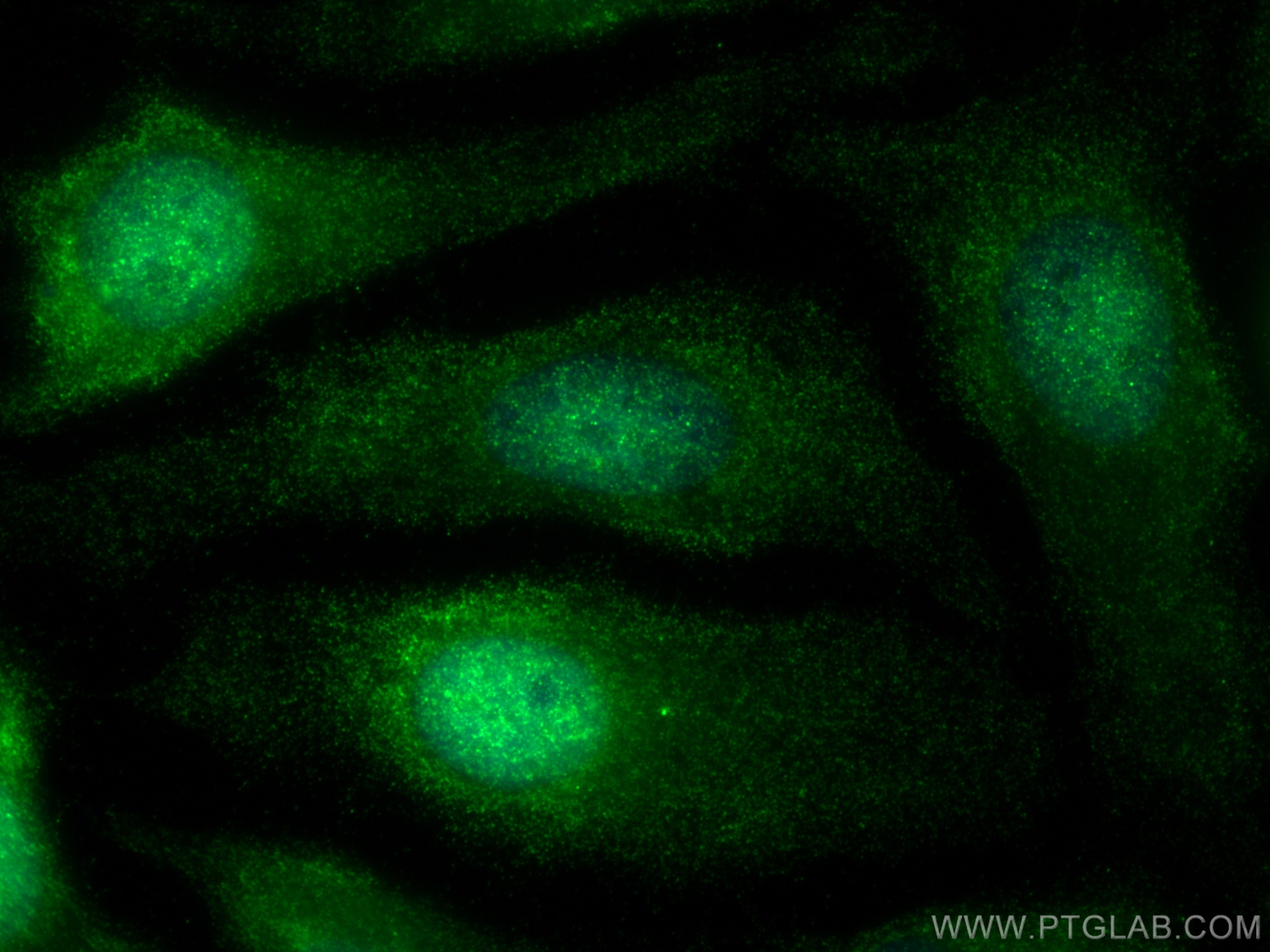 Immunofluorescence (IF) / fluorescent staining of HeLa cells using Galectin 3 Recombinant antibody (82024-1-RR)