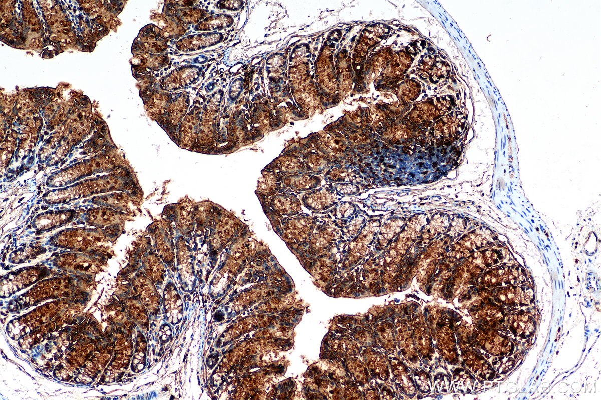 IHC staining of mouse colon using 84889-3-RR Immunohistochemistry (IHC) staining of mouse colon tissue using Galectin-3 Recombinant monoclonal antibody (84889-3-RR)