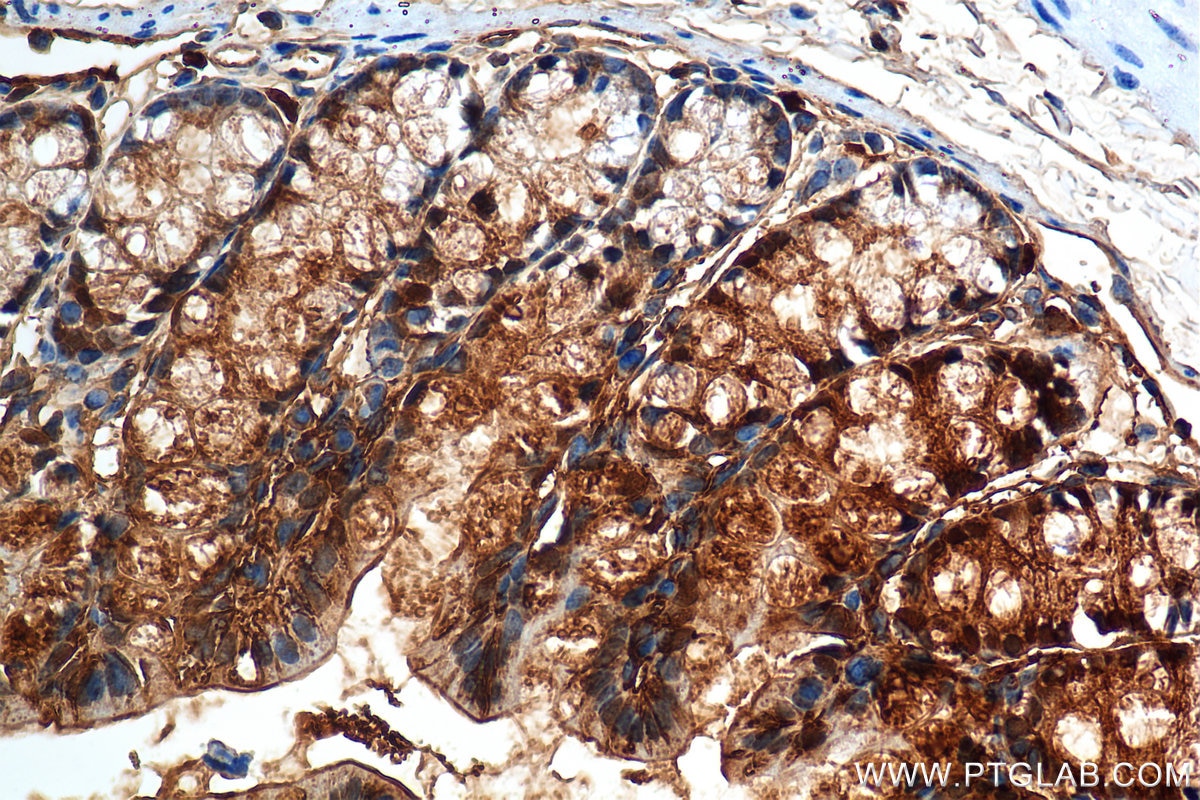 IHC staining of mouse colon using 84889-3-RR Immunohistochemistry (IHC) staining of mouse colon tissue using Galectin-3 Recombinant monoclonal antibody (84889-3-RR)