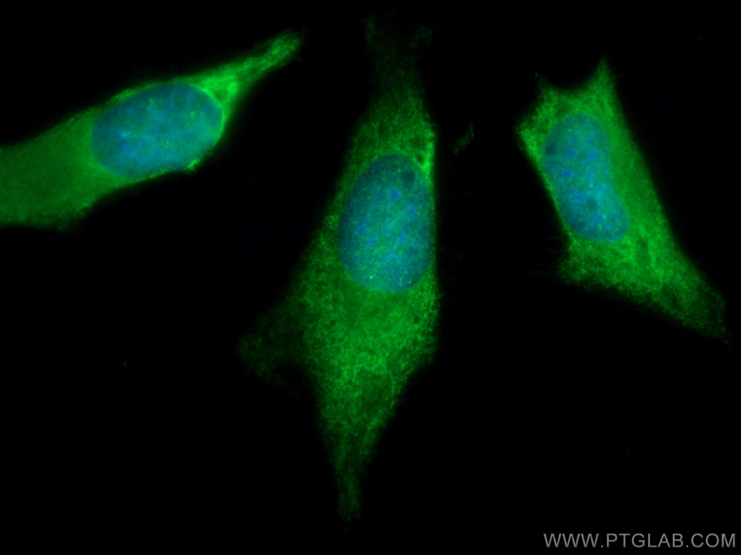 Immunofluorescence (IF) / fluorescent staining of HeLa cells using CoraLite® Plus 488-conjugated Galectin-3 Polyclona (CL488-14979)