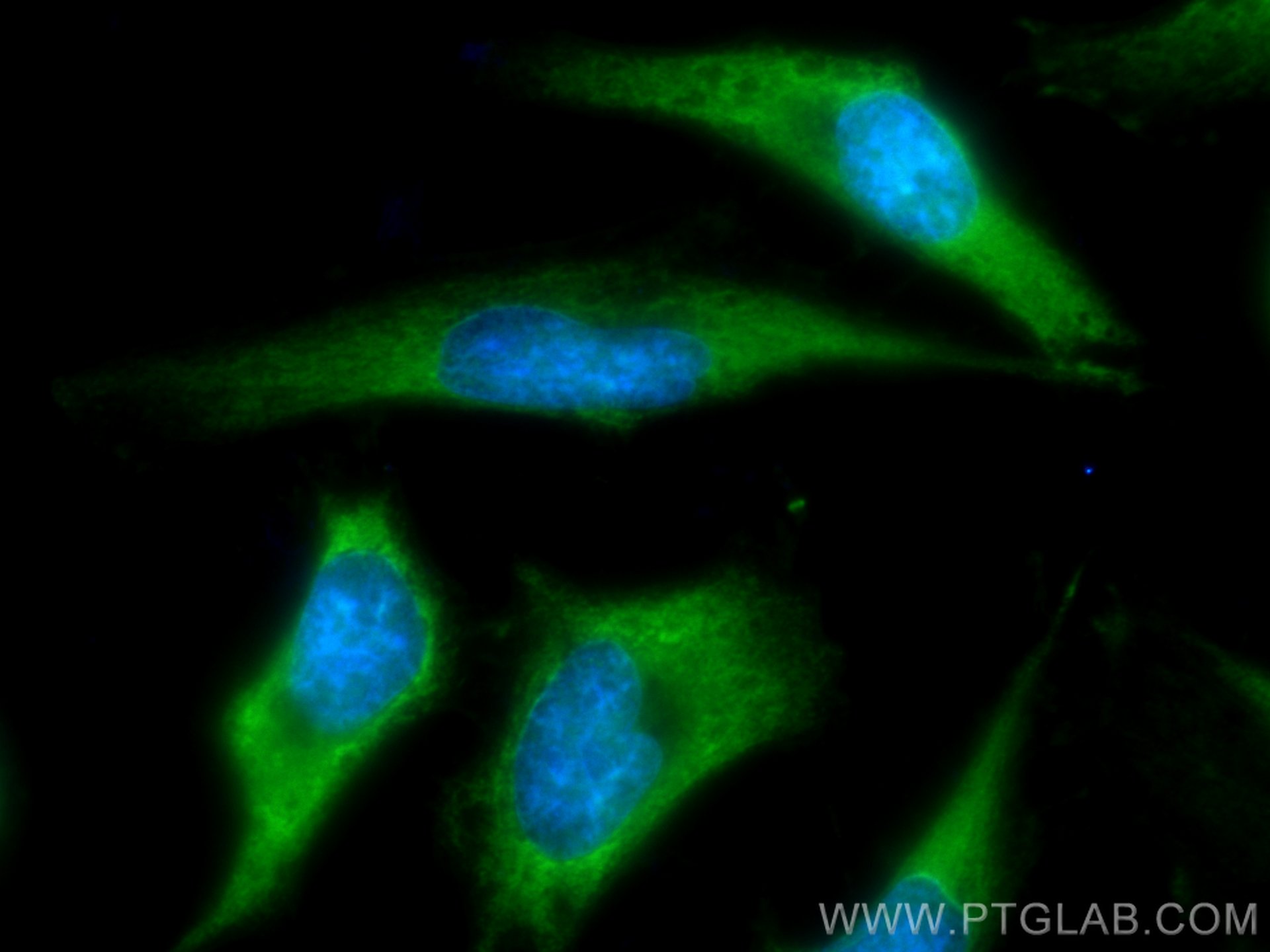 Immunofluorescence (IF) / fluorescent staining of HeLa cells using CoraLite® Plus 488-conjugated Galectin-3 Monoclona (CL488-60207)