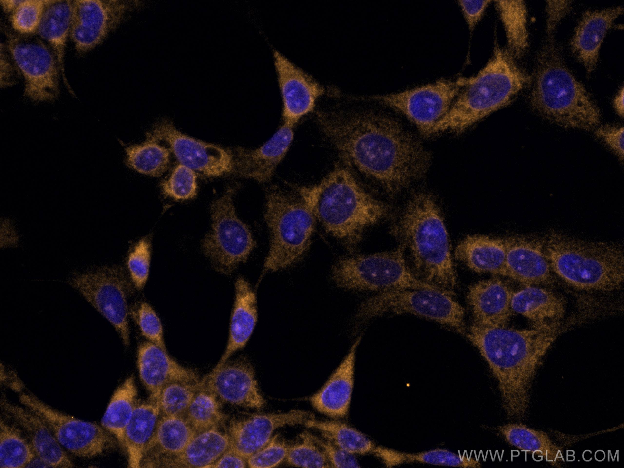 Immunofluorescence (IF) / fluorescent staining of A431 cells using CoraLite®555-conjugated Galectin-3 Monoclonal anti (CL555-60207)