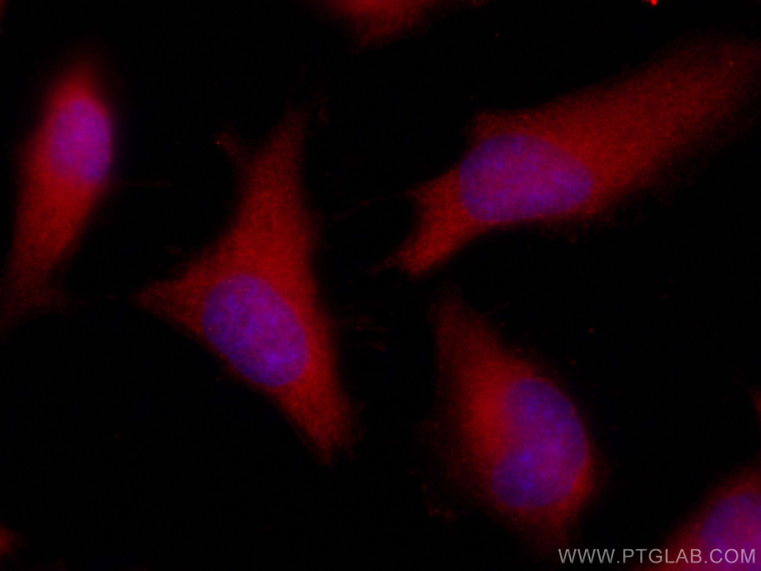 Immunofluorescence (IF) / fluorescent staining of HeLa cells using CoraLite®594-conjugated Galectin-3 Polyclonal anti (CL594-14979)