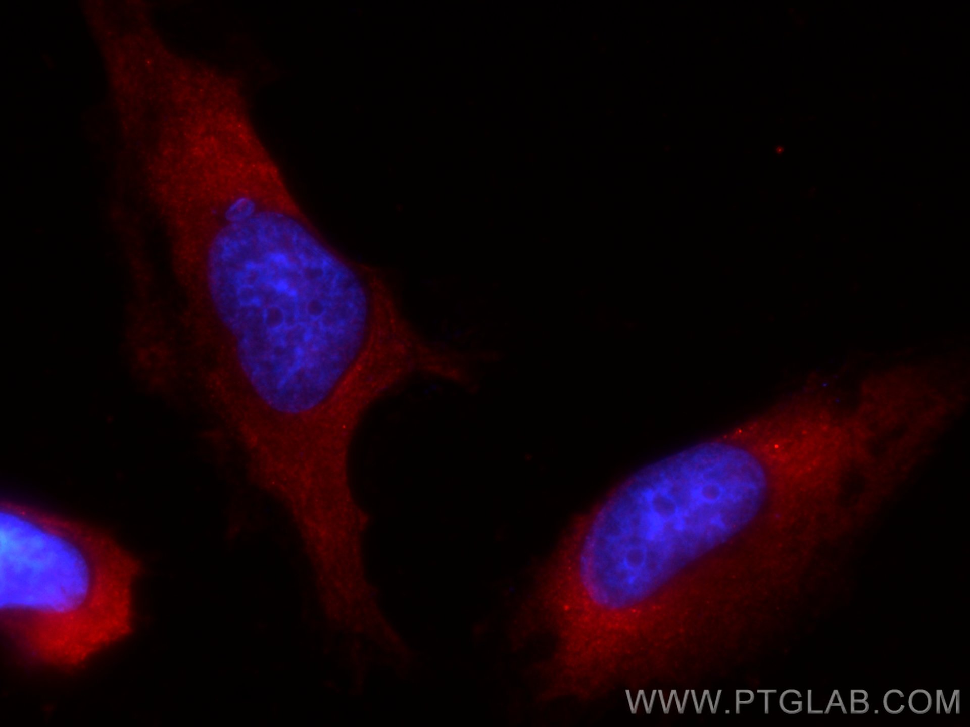 Immunofluorescence (IF) / fluorescent staining of HeLa cells using CoraLite®594-conjugated Galectin-3 Monoclonal anti (CL594-60207)