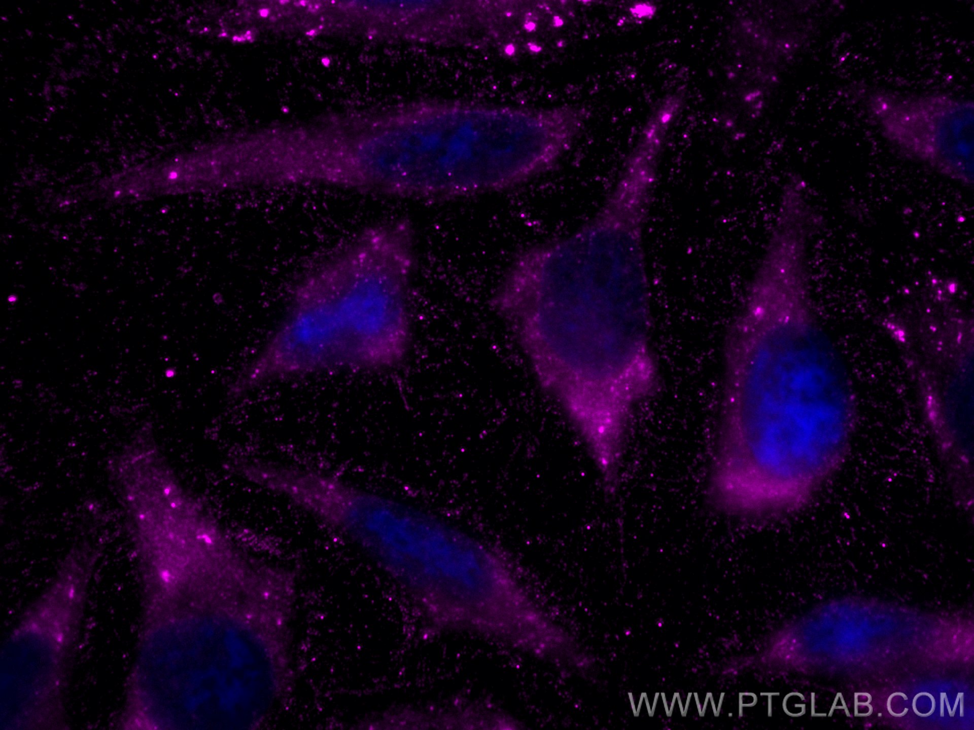 Immunofluorescence (IF) / fluorescent staining of HeLa cells using CoraLite® Plus 647-conjugated Galectin-3 Monoclona (CL647-60207)