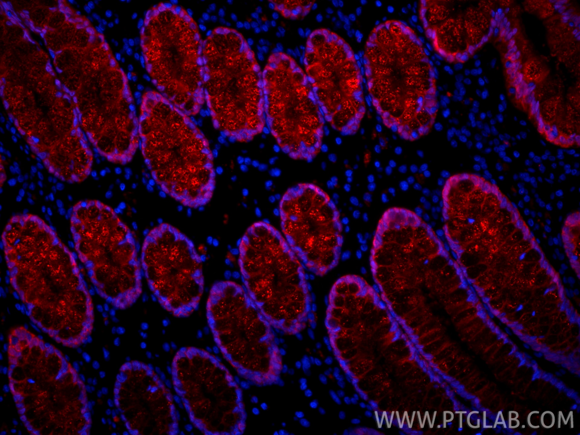 Immunofluorescence (IF) / fluorescent staining of human large intestine tissue using CoraLite®594-conjugated Galectin-4 Monoclonal anti (CL594-66686)