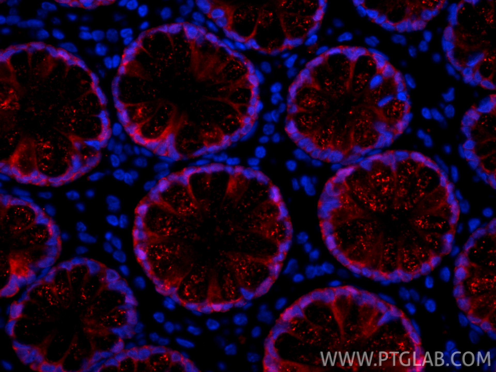 Immunofluorescence (IF) / fluorescent staining of human large intestine tissue using CoraLite®594-conjugated Galectin-4 Monoclonal anti (CL594-66686)