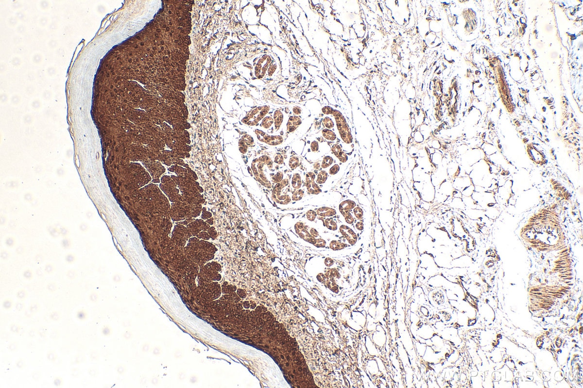 Immunohistochemistry (IHC) staining of mouse skin tissue using Galectin-7 Polyclonal antibody (16730-1-AP)