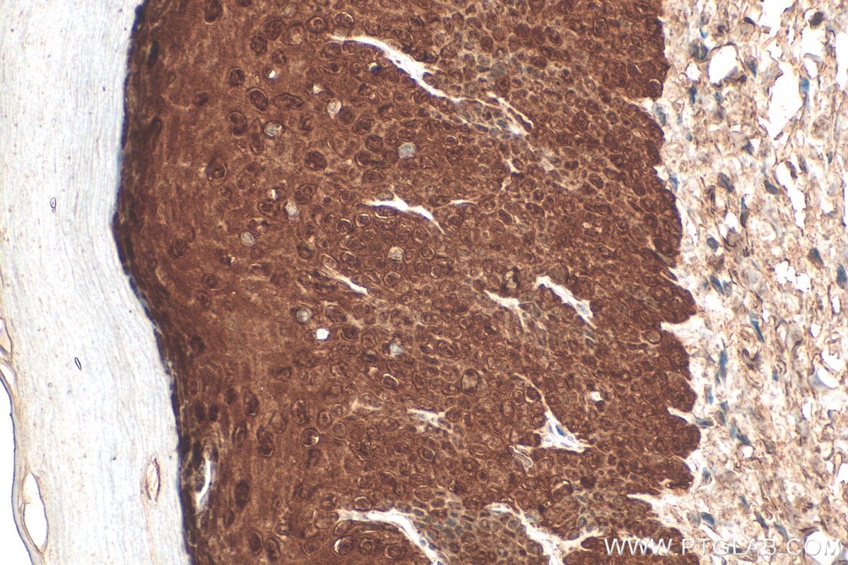 Immunohistochemistry (IHC) staining of mouse skin tissue using Galectin-7 Polyclonal antibody (16730-1-AP)