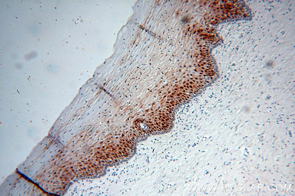 IHC staining of human cervix using 16730-1-AP