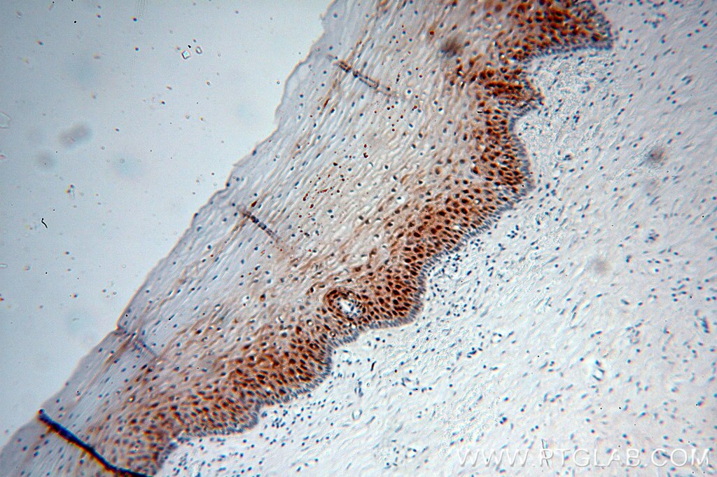 Immunohistochemistry (IHC) staining of human cervix tissue using Galectin-7 Polyclonal antibody (16730-1-AP)