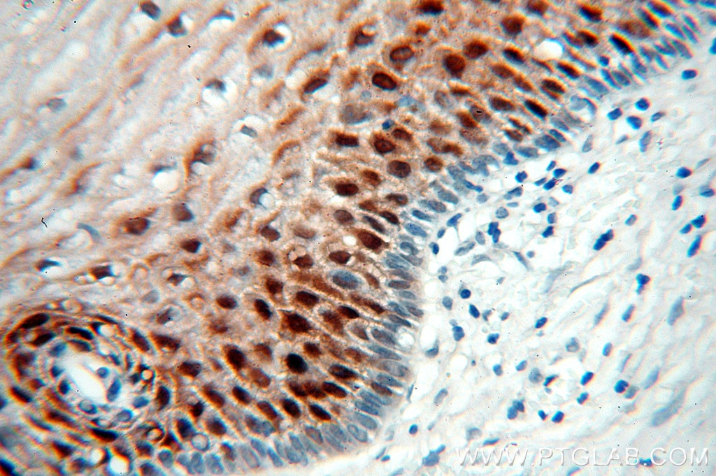 Immunohistochemistry (IHC) staining of human cervix tissue using Galectin-7 Polyclonal antibody (16730-1-AP)