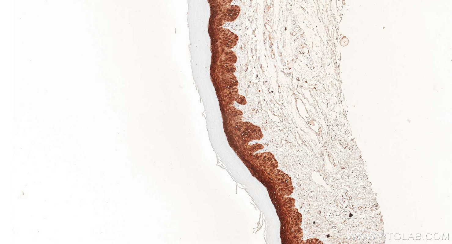 Immunohistochemistry (IHC) staining of rat skin tissue using Galectin-7 Polyclonal antibody (34369-1-AP)