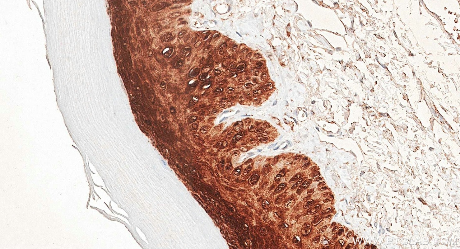 Immunohistochemistry (IHC) staining of rat skin tissue using Galectin-7 Polyclonal antibody (34369-1-AP)