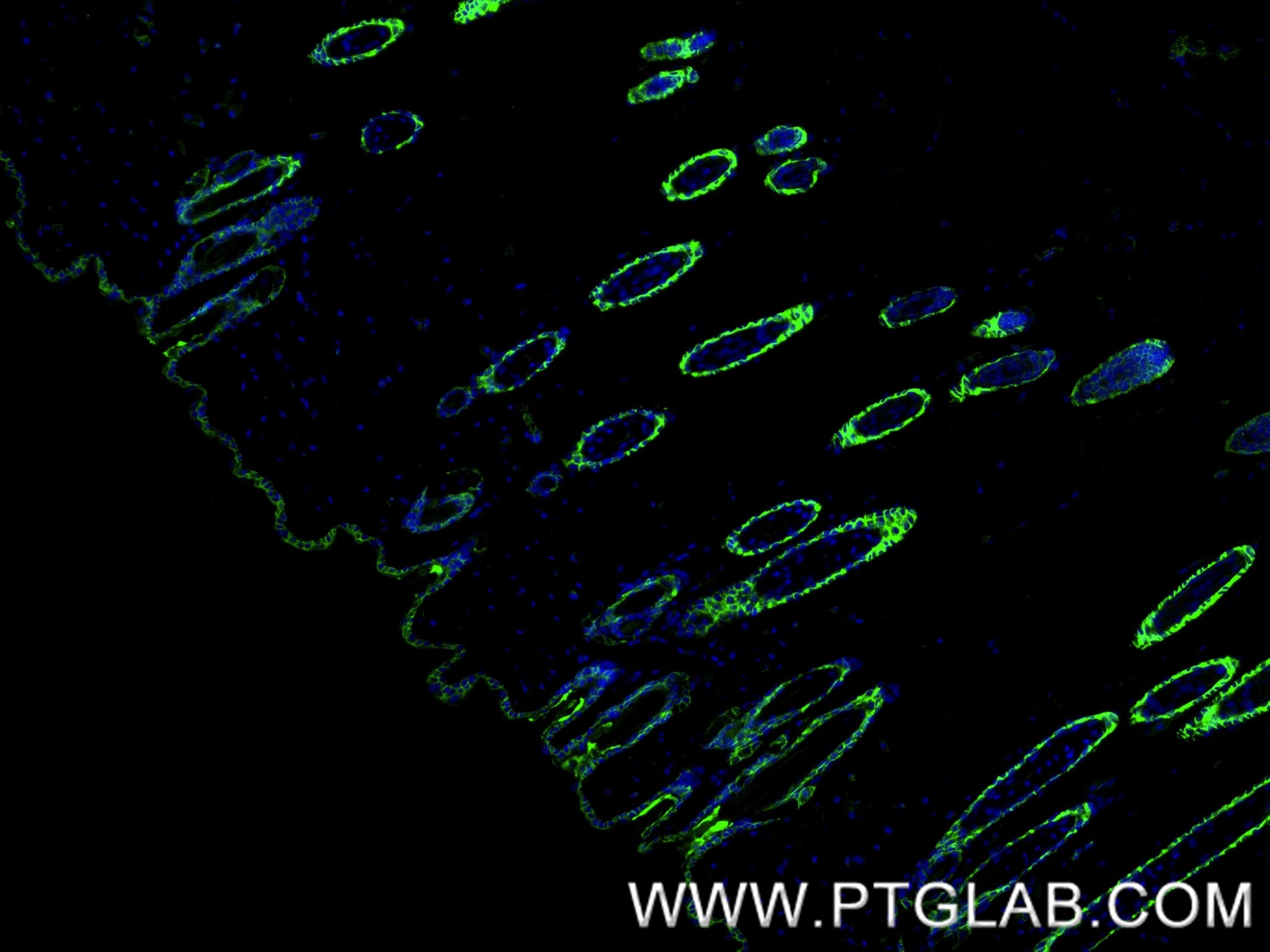 Immunofluorescence (IF) / fluorescent staining of mouse skin tissue using Galectin-7 Recombinant monoclonal antibody (87943-1-RR)