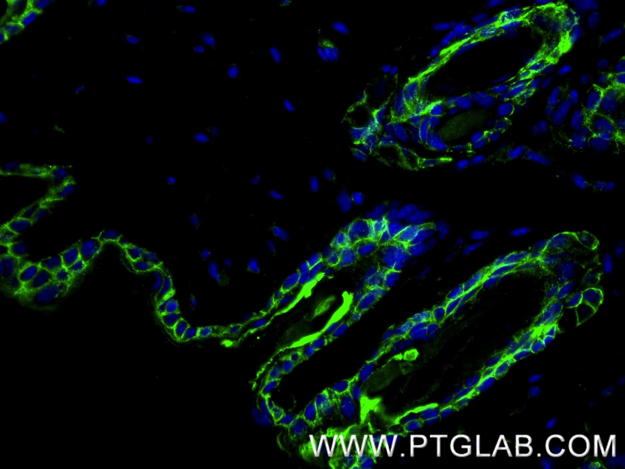 Immunofluorescence (IF) / fluorescent staining of mouse skin tissue using Galectin-7 Recombinant monoclonal antibody (87943-1-RR)