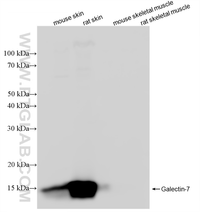 Western Blot (WB) analysis of various lysates using Galectin-7 Recombinant monoclonal antibody (87943-1-RR)