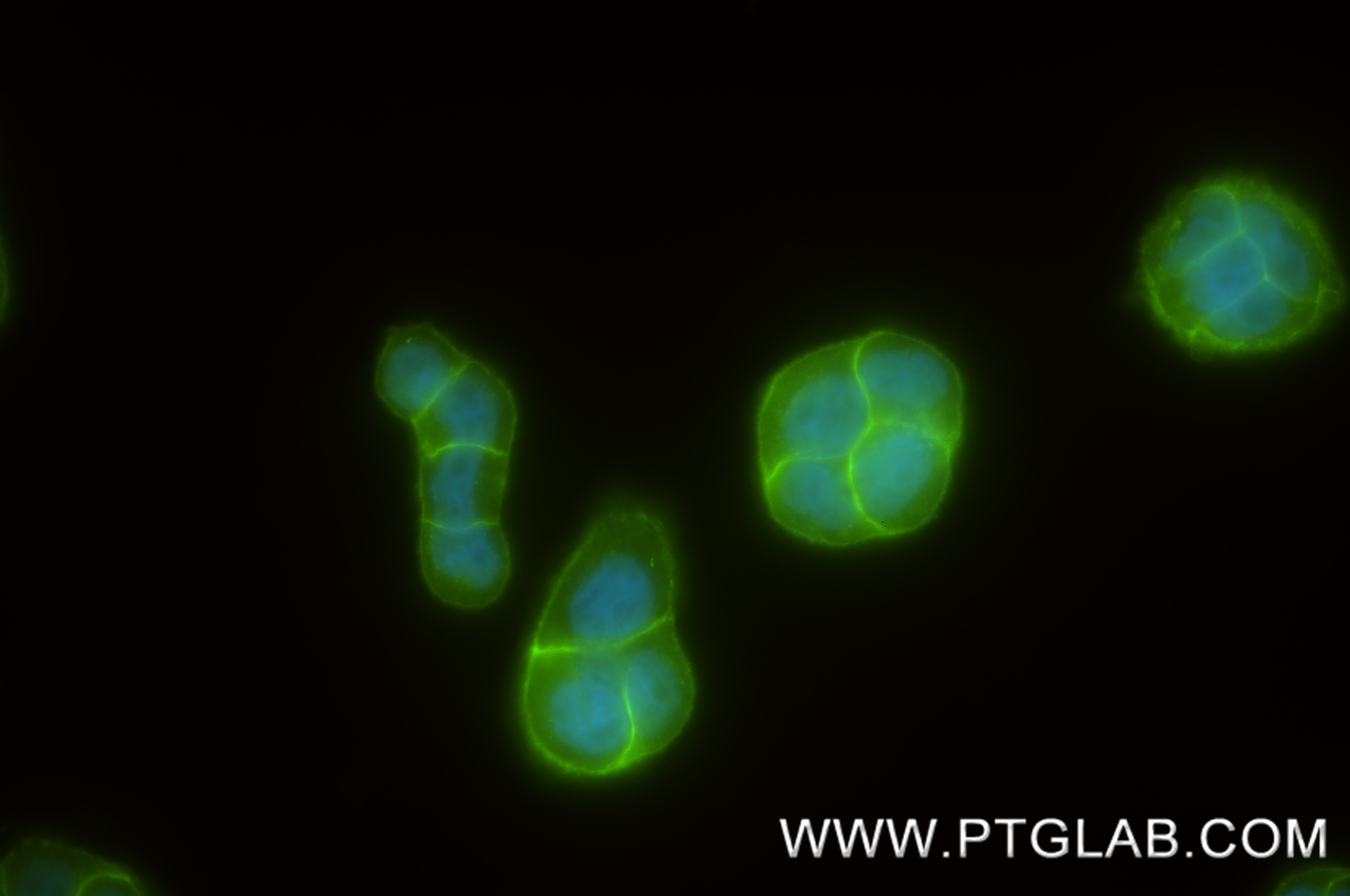 IF Staining of HT-29 using 88895-2-RR (same clone as 88895-2-PBS) Immunofluorescence (IF) / fluorescent staining of HT-29 cells using Gamma Catenin Recombinant monoclonal antibody (88895-2-RR)