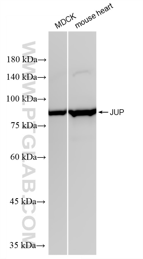 WB analysis using 88895-2-RR (same clone as 88895-2-PBS) Western Blot (WB) analysis of various lysates using Gamma Catenin Recombinant monoclonal antibody (88895-2-RR)