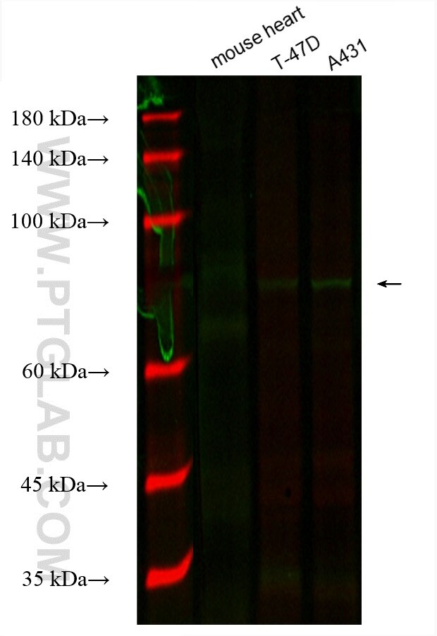 Western Blot (WB) analysis of various lysates using CoraLite® Plus 488-conjugated Gamma Catenin Monocl (CL488-66445)