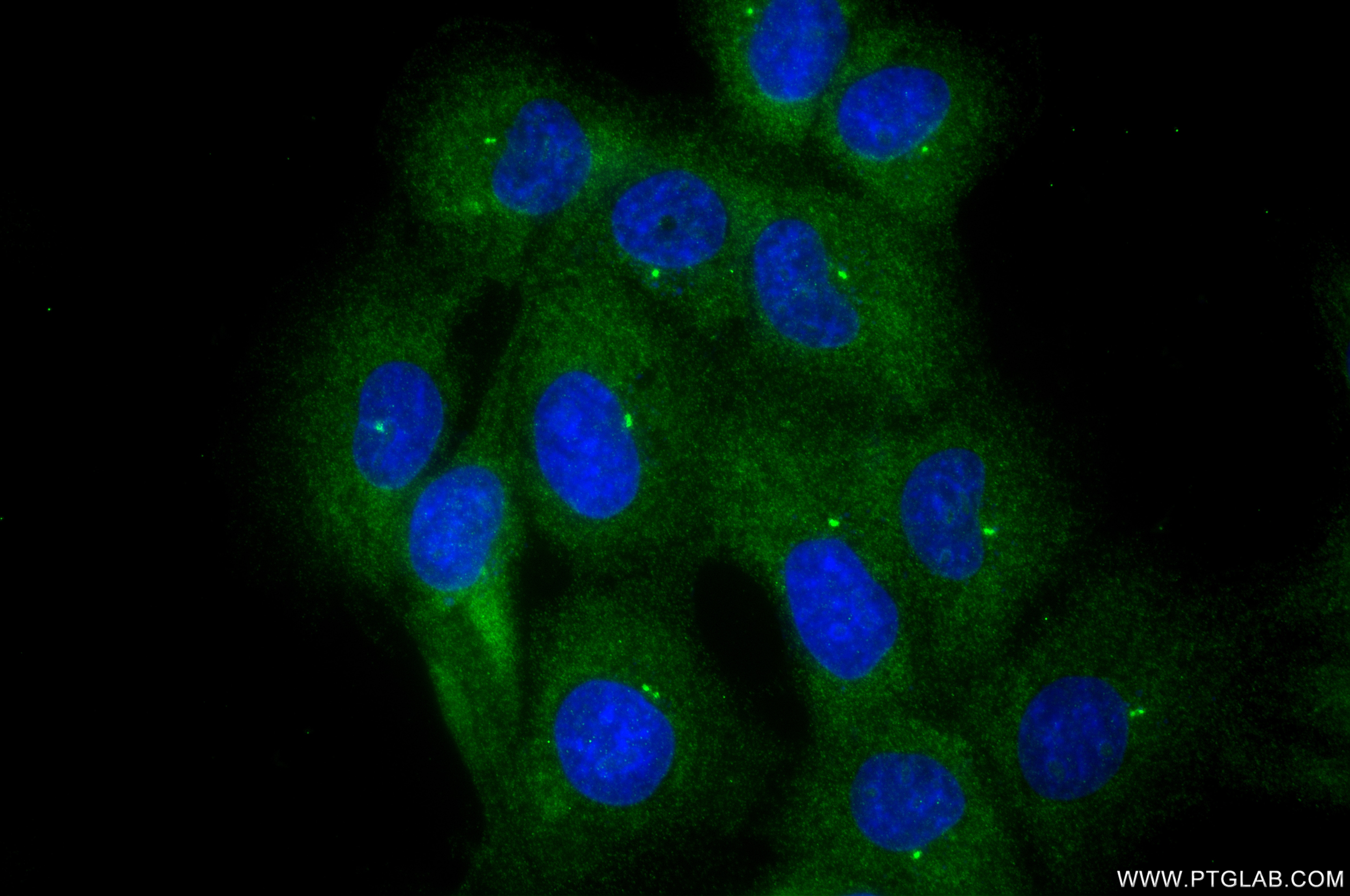 Immunofluorescence (IF) / fluorescent staining of A431 cells using Gamma Tubulin Recombinant monoclonal antibody (87860-2-RR)