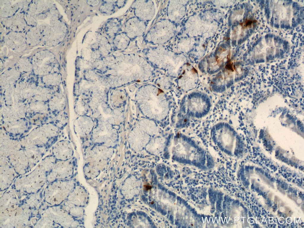 Immunohistochemistry (IHC) staining of human stomach tissue using Gastrin Monoclonal antibody (60346-1-Ig)