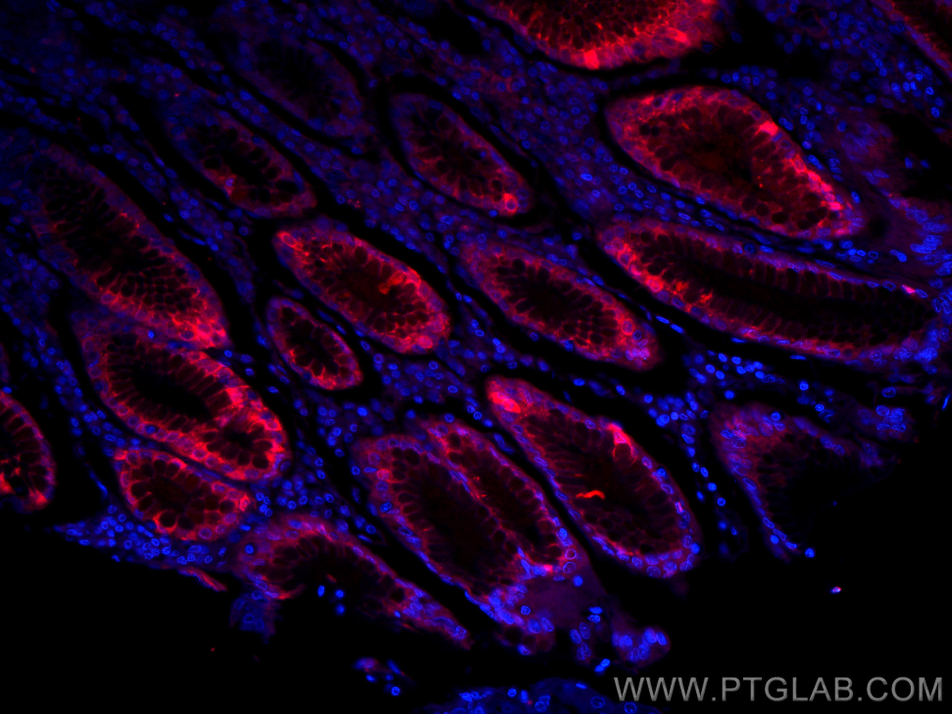 Immunofluorescence (IF) / fluorescent staining of human stomach tissue using CoraLite®594-conjugated Gastrokine 1 Monoclonal an (CL594-60130)