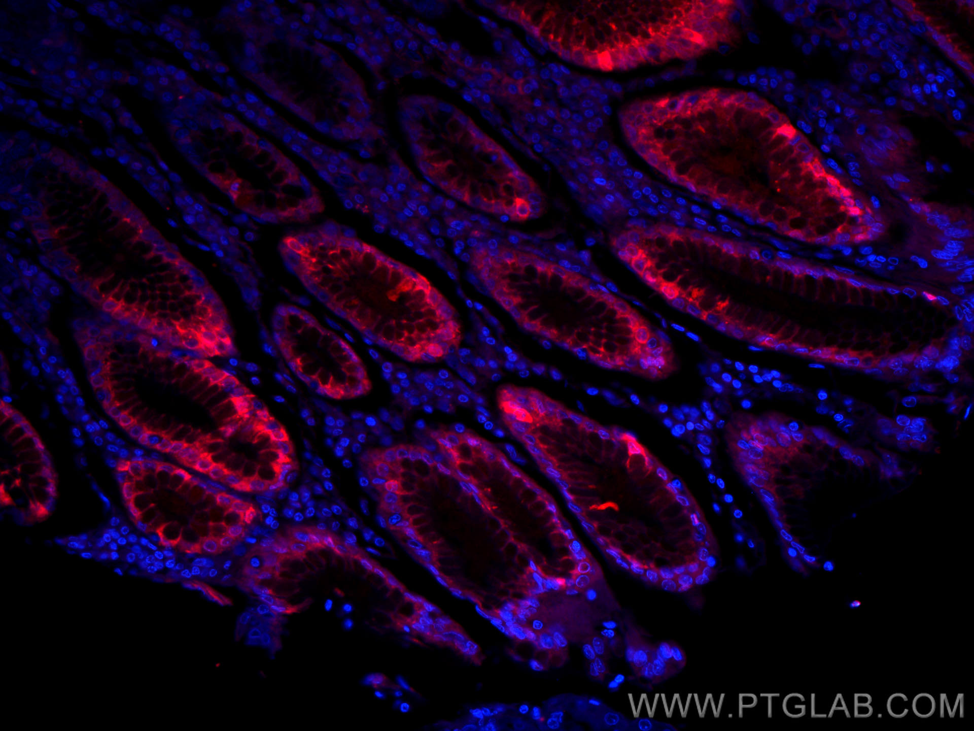 IF Staining of human stomach using CL594-60130