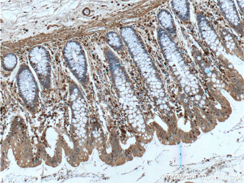 Immunohistochemistry (IHC) staining of human colon tissue using Gelsolin Monoclonal antibody (66280-1-Ig)