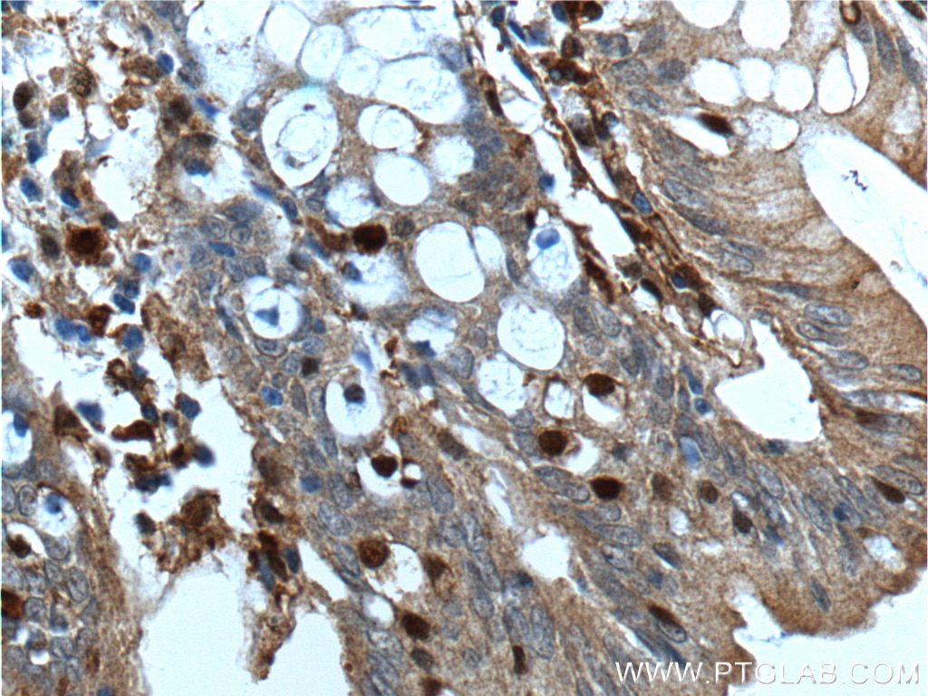 Immunohistochemistry (IHC) staining of human colon tissue using Gelsolin Monoclonal antibody (66280-1-Ig)