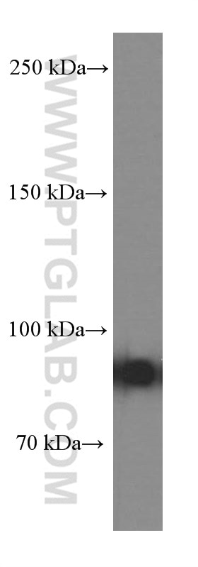 Western Blot (WB) analysis of A549 cells using Gelsolin Monoclonal antibody (66280-1-Ig)