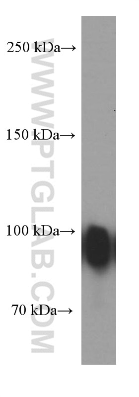 Western Blot (WB) analysis of human plasma using Gelsolin Monoclonal antibody (66280-1-Ig)